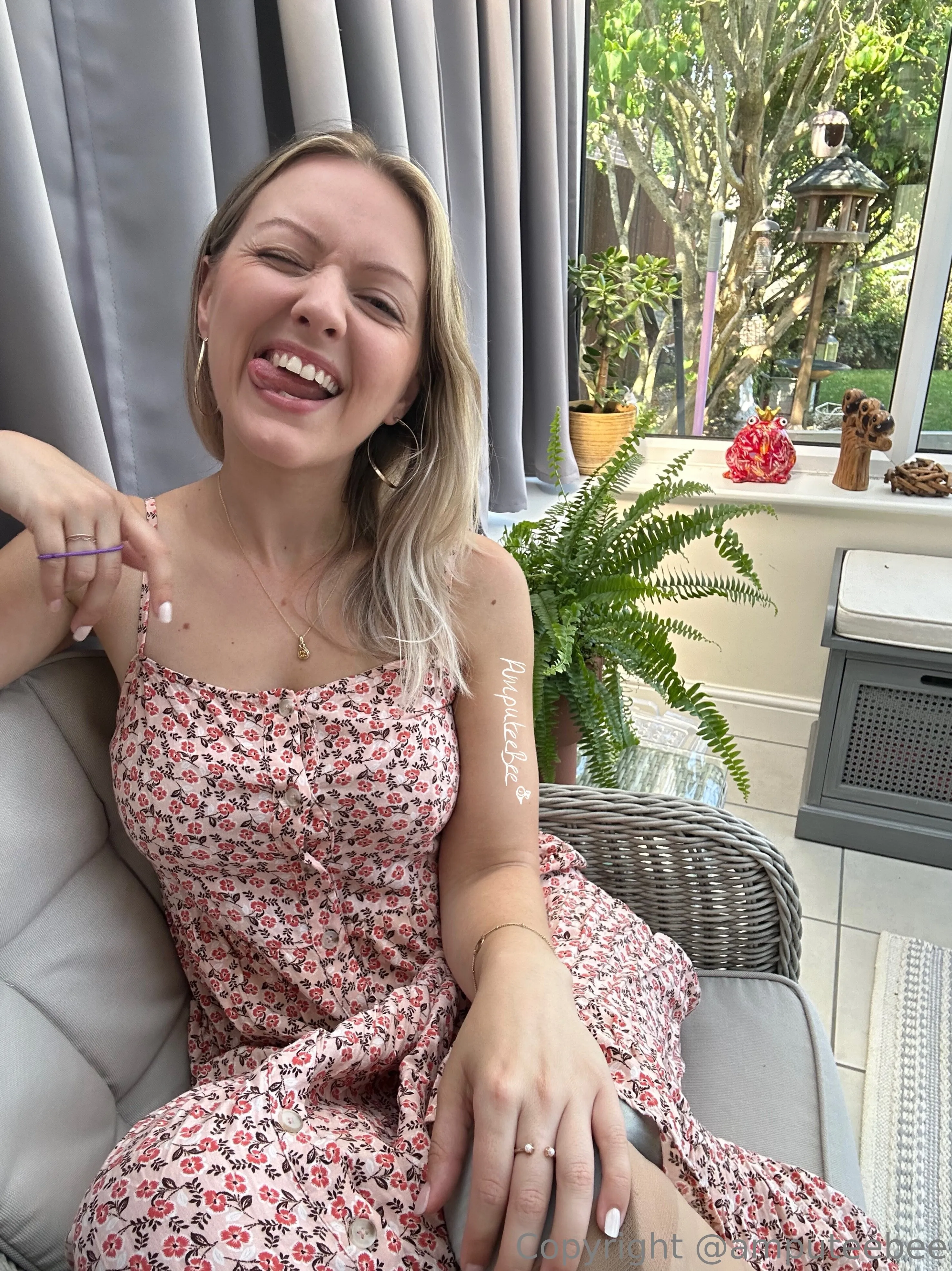 Amputee Bee 🐝🍯🦿🖤💋