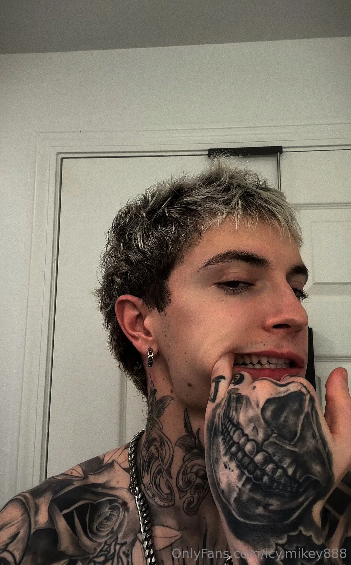 Icy Mikey before weight loss