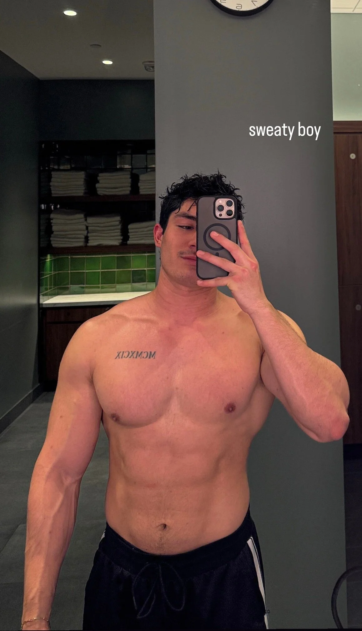 Alex real or implants