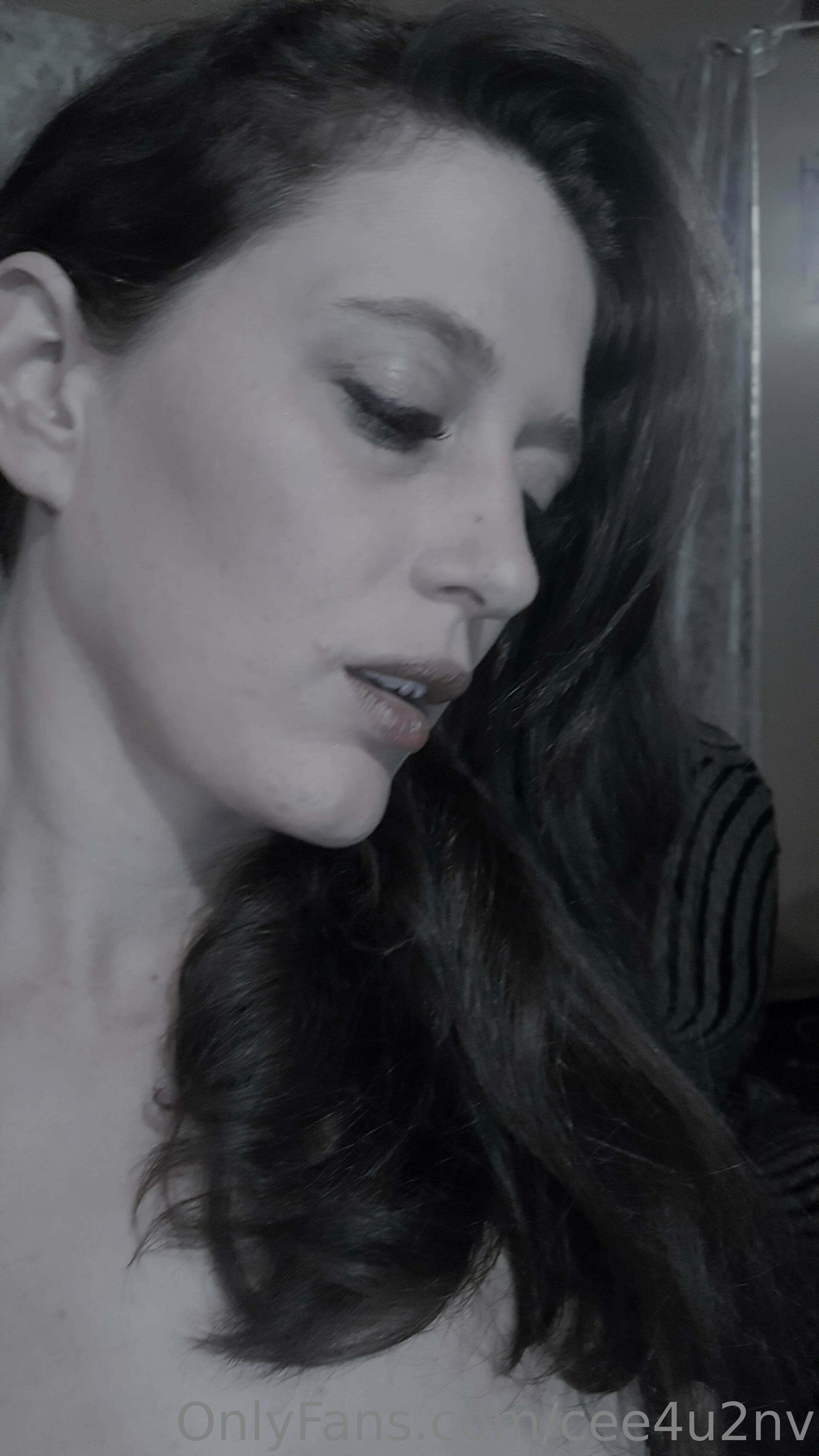 cee4u2nv -Free @cee4u2nv eyelid surgery