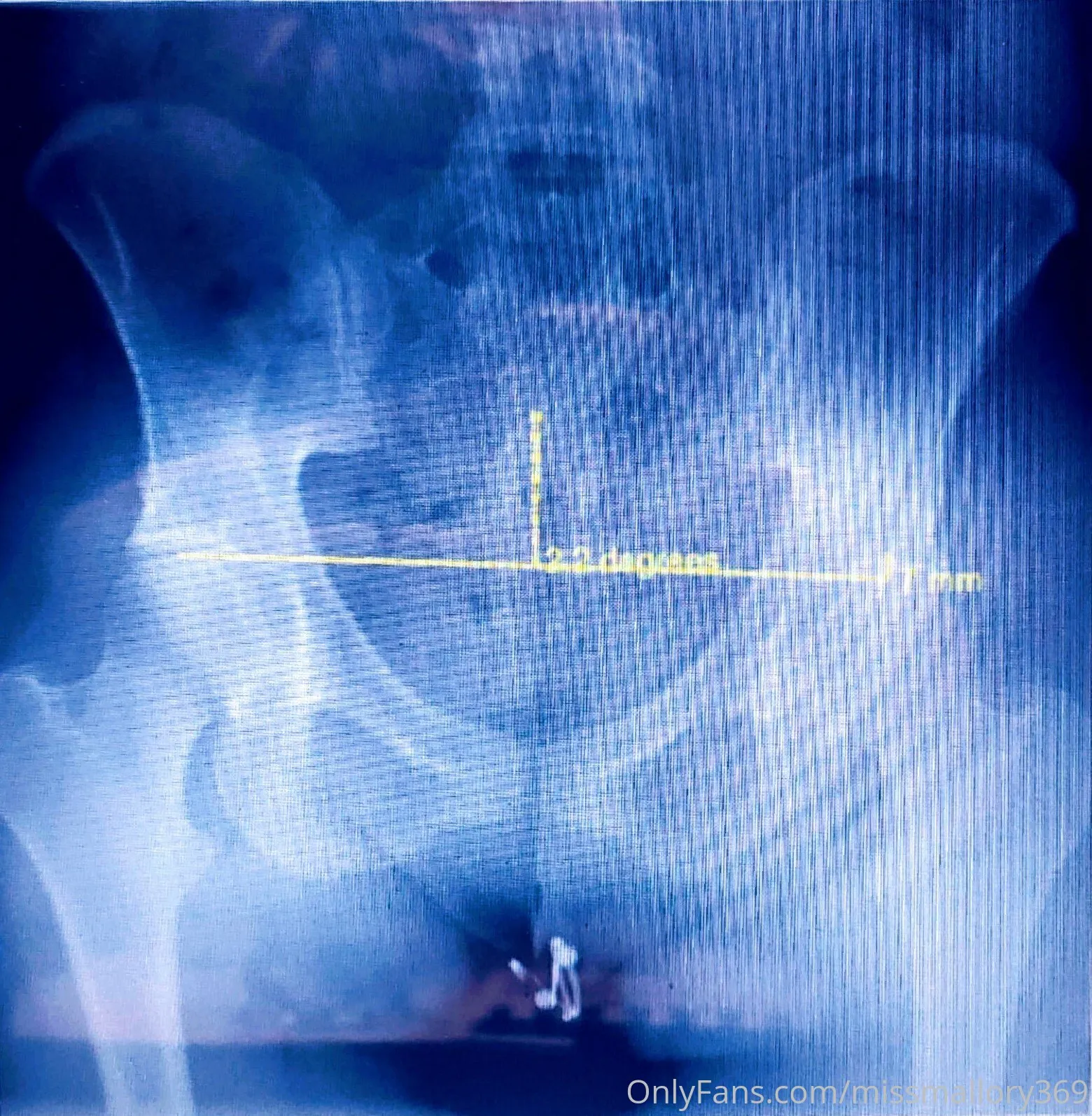 Miss Mallory @missmallory369 naked pics