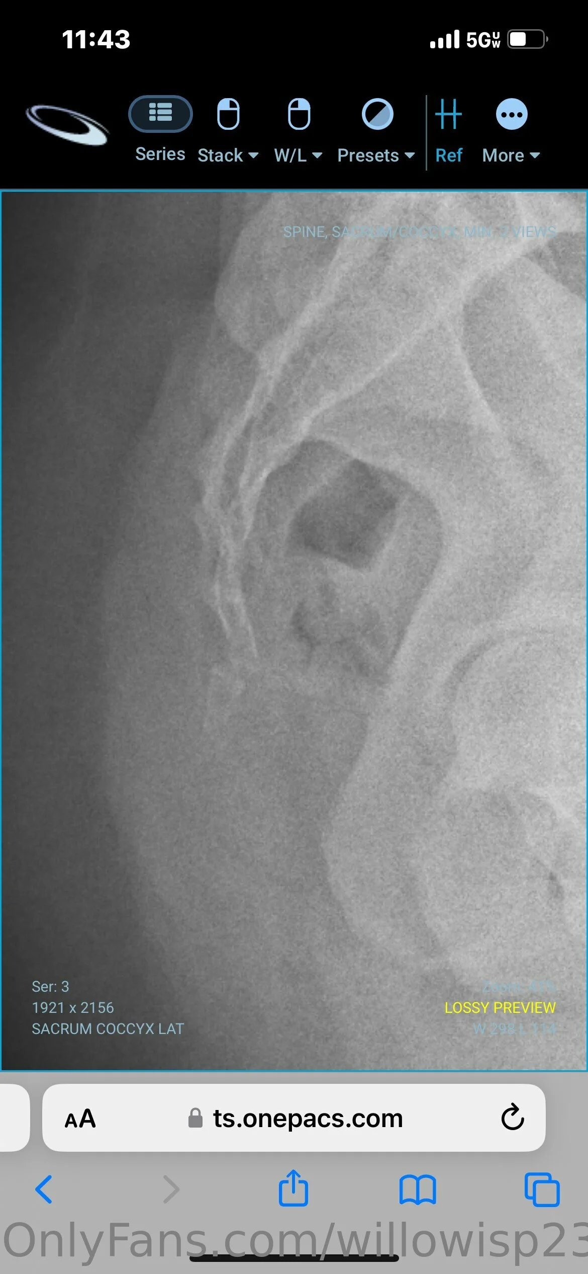 🥀Willow🥀 nude Photo /  Porn - Photo #10